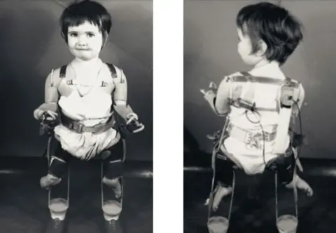 Chalk Productions/Alison Lapper A black and white image of Alison Lapper as a small child wearing artificial legs. There are two pictures, side by side. One is of Alison facing the front and the other, facing the back.