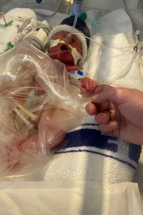 Atlanta Mcintyre A newborn baby still in hospital, clutching its parents' finger.